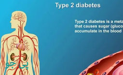 دیابت نوع 2 چیست؟ از درمان تا پیشگیری