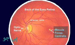 رتینیت چشم چیست و چگونه درمان می شود؟