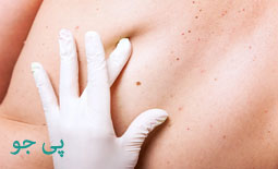 مهم ترین علائم پوستی سلیاک چیست؟