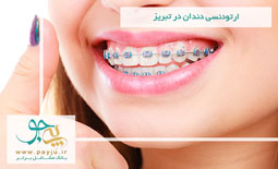 ارتودنسی دندان در تبریز