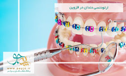 ارتودنسی دندان در قزوین