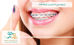 ارتودنسی دندان در کرمانشاه