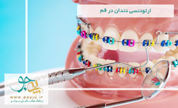 ارتودنسی دندان در قم