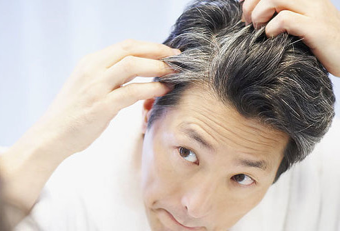 ۵ راه‌ حل عالی برای رفع سفیدی مو