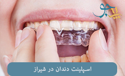 اسپلینت دندان در شیراز