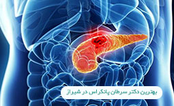 بهترین دکتر سرطان پانکراس در شیراز