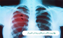 بهترین دکتر سرطان ریه در شیراز