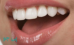 لیست دندانپزشکان متخصص بلیچینگ و سفید کردن دندان در بیرجند