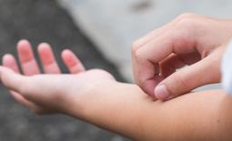 توصیه‌هایی برای کنترل خارش‌ پوست