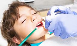 دندانپزشکی تحت بیهوشی در شیراز