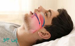 آپنه خواب چیست و چگونه درمان می شود؟