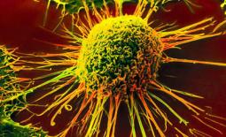 علت، علائم و روش های درمان توده ی هیپو‌‌‌‌‌‌‌‌‌‌اکو چیست؟