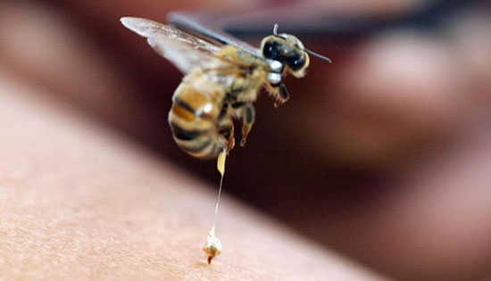 زنبوردرمانی برای درمان کدام بیماری ها مناسب است؟
