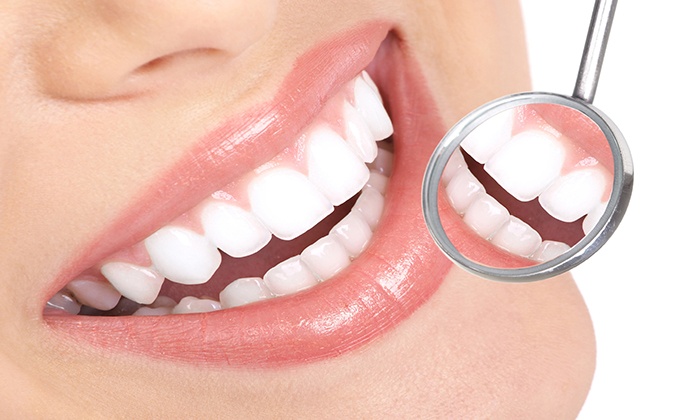 لمینت دندان چیست؟ انواع لمینت دندان ، مزایا و معایب آن
