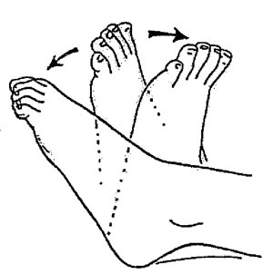 پیشگیری از شین اسپلینت یا درد ساق پا