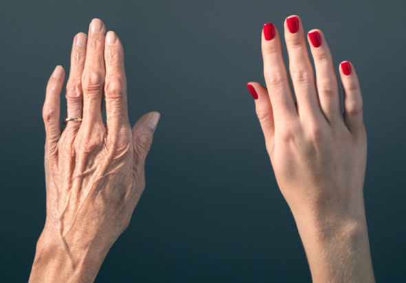 راههای پیشگیری و درمان پیری پوست دست