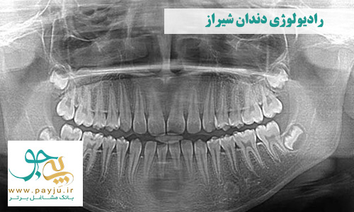 رادیولوژی دندان شیراز