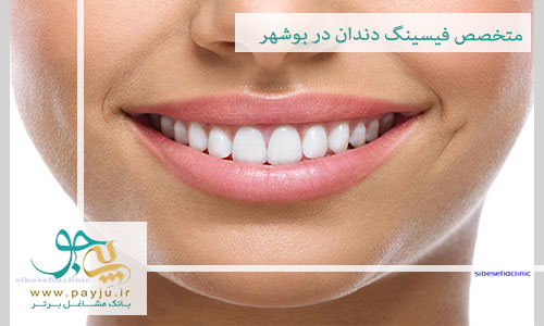دندانپزشکان متخصص فیسینگ دندان در بوشهر