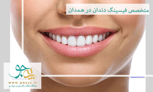 دندانپزشکان متخصص فیسینگ دندان در همدان