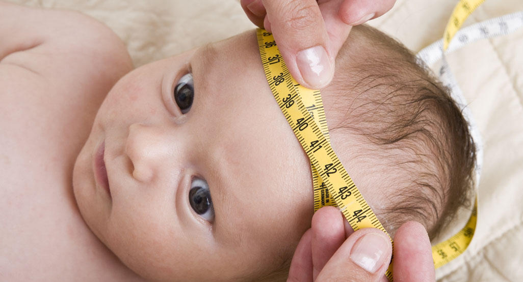بیماری بزرگی سر نوزاد چگونه درمان میشود؟