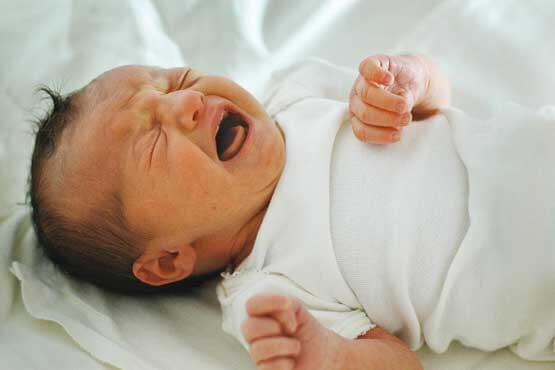 علل و عوارض زردی در نوزادان