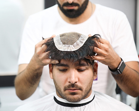 آنچه باید در مورد پروتز موی آقایان بدانیم
