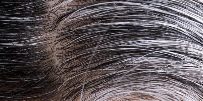 چه عواملی سبب سفیدی زودرس مو می شود؟