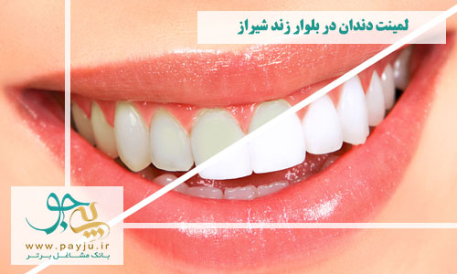  بهترین دندانپزشکان لمینت دندان در بلوار زند شیراز