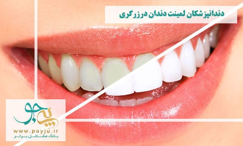 دندانپزشکان لمینت دندان در زرگری شیراز