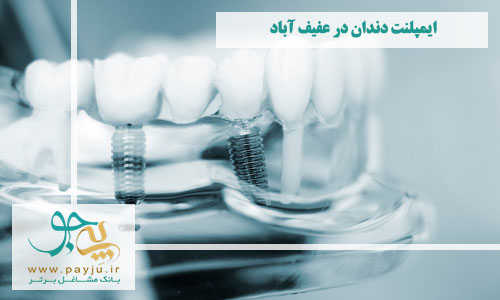  بهترین دندانپزشکان ایمپلنت دندان در عفیف آباد شیراز