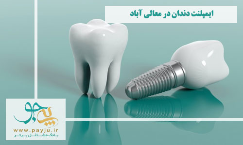 ایمپلنت دندان معالی آباد شیراز