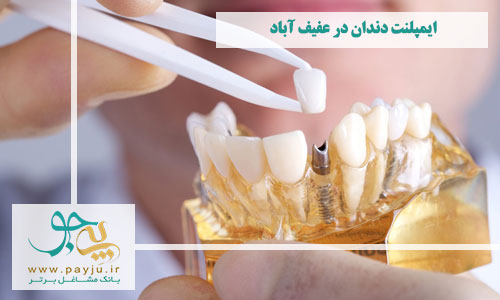 بهترین دندانپزشکان ایمپلنت دندان در قدوسی غربی شیراز