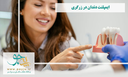 بهترین دندانپزشکان ایمپلنت دندان در زرگری شیراز