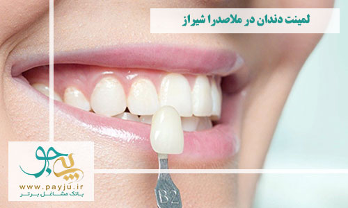 بهترین دندانپزشکان لمینت دندان در ملاصدرا شیراز