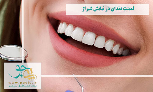 دندانپزشکان لمینت دندان در نیایش شیراز