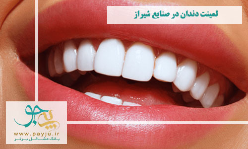 بهترین دندانپزشکان لمینت دندان در صنایع شیراز