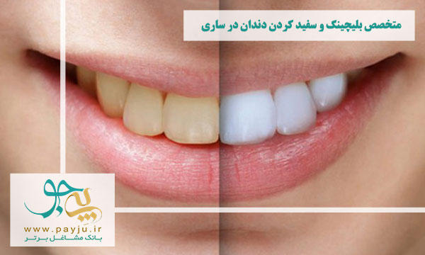 لیست دندانپزشکان متخصص بلیچینگ و سفید کردن دندان در ساری