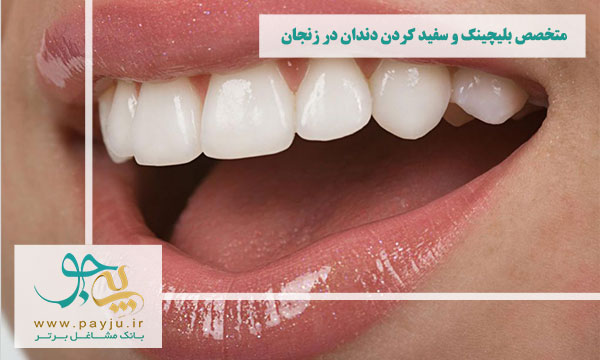 لیست دندانپزشکان متخصص بلیچینگ و سفید کردن دندان در زنجان