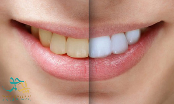 لیست دندانپزشکان بلیچینگ و سفید کردن دندان در اراک