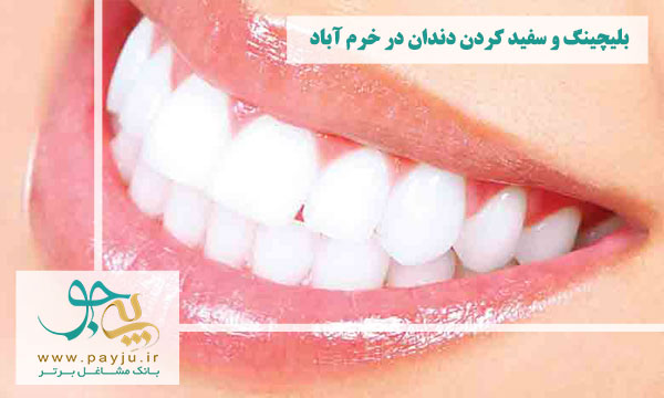 لیست دندانپزشکان بلیچینگ و سفید کردن دندان در خرم آباد