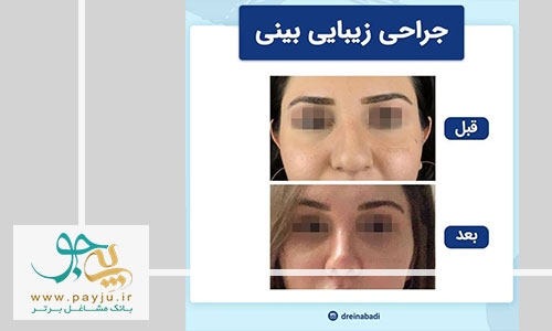 نمونه کار دکتر وحید عین آبادی جراح زیبایی در شیراز