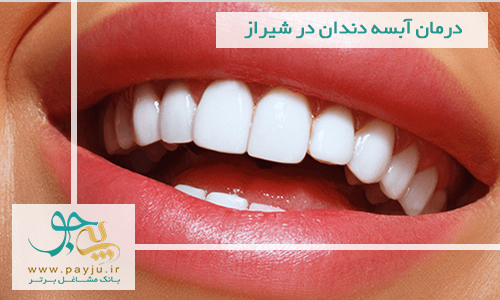 درمان آبسه دندان در شیراز