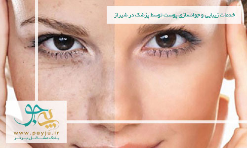 خدمات زیبایی و جوانسازی پوست توسط پزشک در شیراز