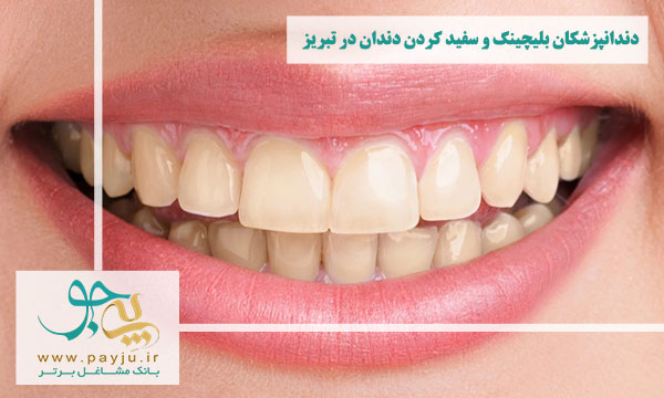 لیست دندانپزشکان بلیچینگ و سفید کردن دندان در تبریز