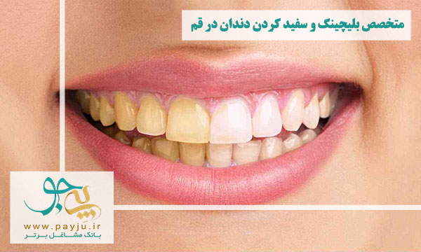 لیست دندانپزشکان متخصص بلیچینگ و سفید کردن دندان در قم