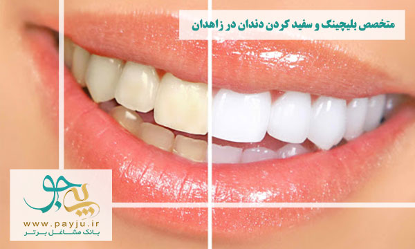 لیست دندانپزشکان متخصص بلیچینگ و سفید کردن دندان در زاهدان