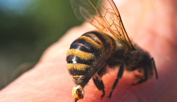 زنبور درمانی ؛ درمان بیماری ها با نیش زنبور