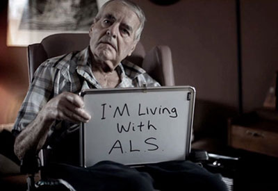 بیماری ALS یا اسکلروز جانبی آمیوتروفیک چیست؟