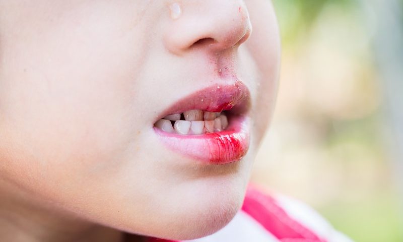 آسیب های دندانی در کودکان کدامند؟
