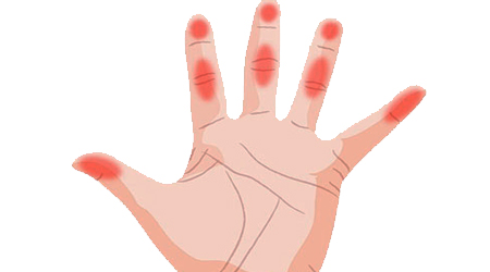 علت بی حسی انگشتان دست چیست؟